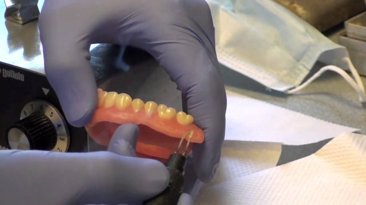 Denture Soft Reline Part 2