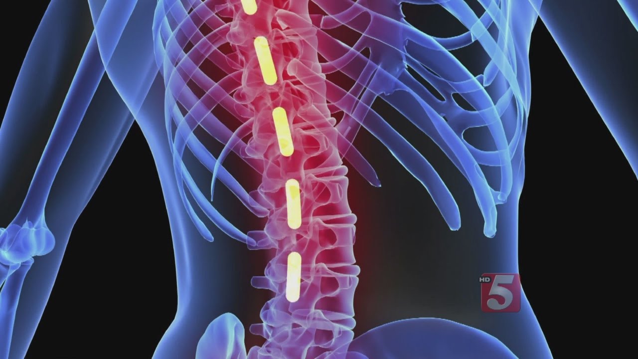 Stem Cells For Paralysis