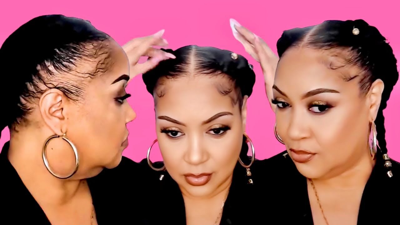 Hide Bald Edges Alopecia Hairstyle | French Braids