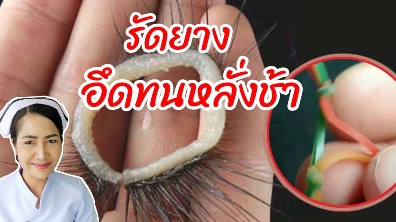 ใช้ยางรัดช่วยให้อึดทนหลั่งช้าลงจริงไหม?