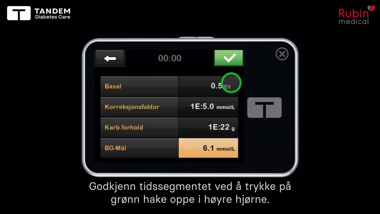 Ny personlig profil i Tandem t:slim X2 insulinpumpe