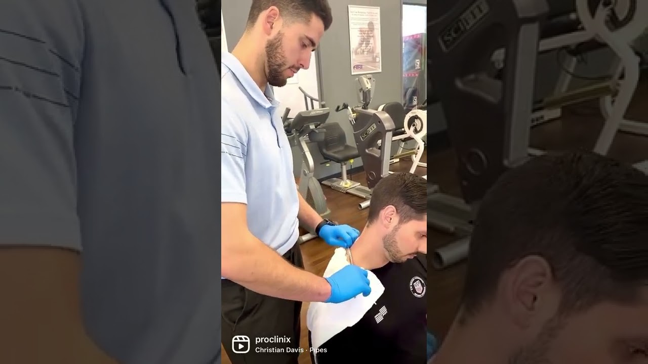 ProClinix - Instrument assisted soft tissue mobilization on an upper trap to relieve neck pain