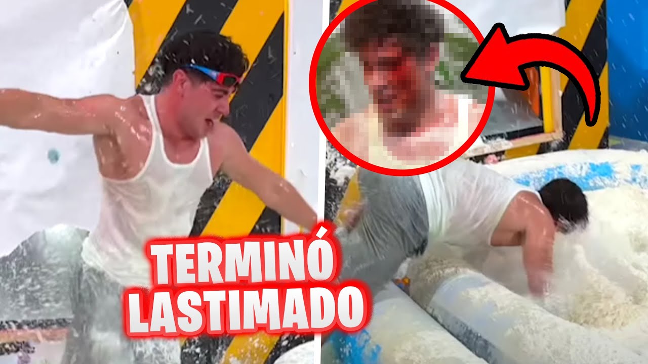 ALEJO IGOA TUVO UN ACCIDENTE MIENTRAS GRABABA ESTE VIDEO 😨😨