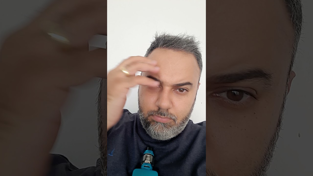 Ex Careca
