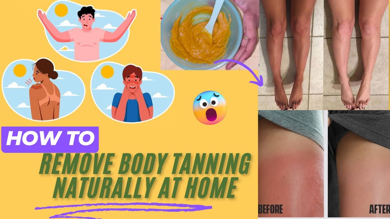 HOW TO REMOVE BODY TANNING NATURALLY  AT HOME😱 ||Home remedy for Sun tan 100% Effective Result ￼👌