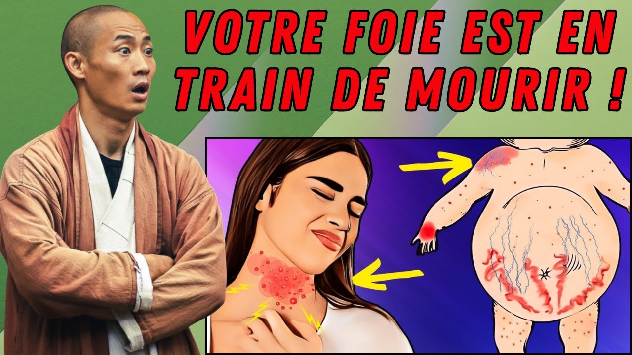 MENACE SILENCIEUSE ! Ces 8 signes pourraient indiquer une stéatose hépatique ! | Shi Heng Yi