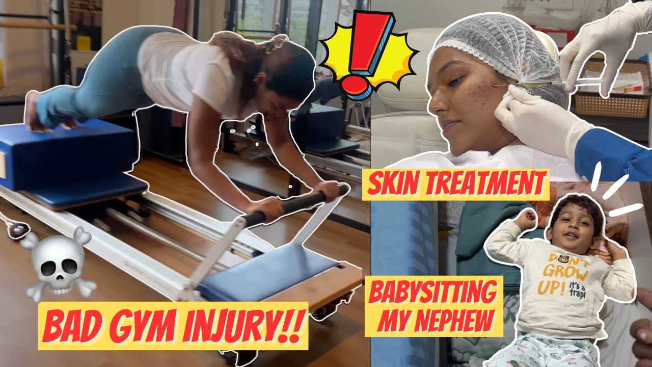 I had a BAD Gym Accident...