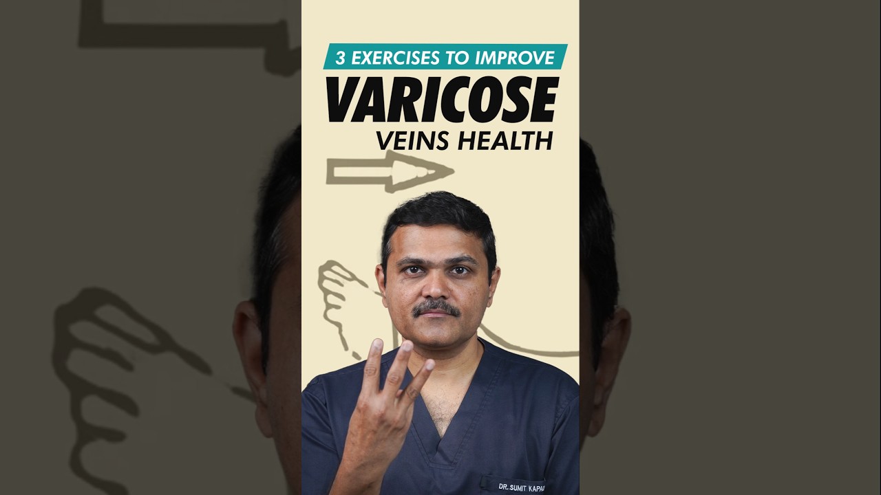 Varicose Vein EXPERT Shares Top 3 Exercises for Relief