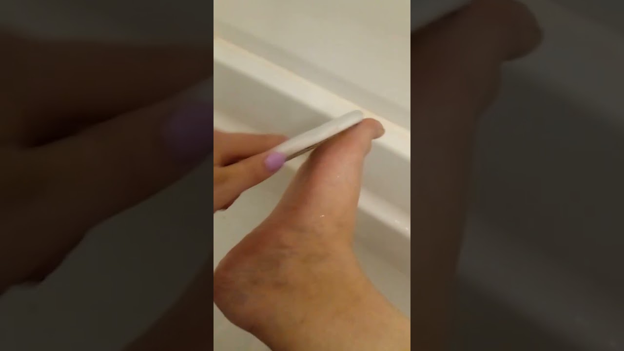 Removing Calluses 