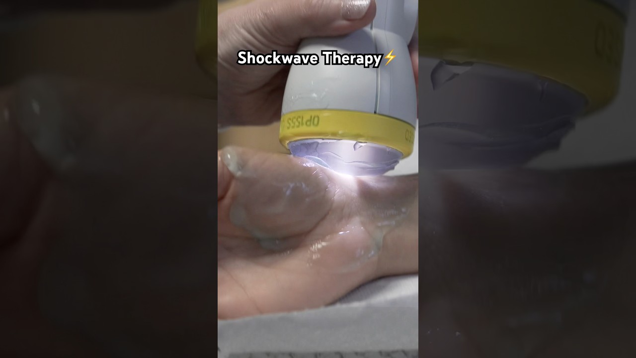 Shockwave Therapy⚡️ You Need to Try This! #shockwave #shockwavetherapy
