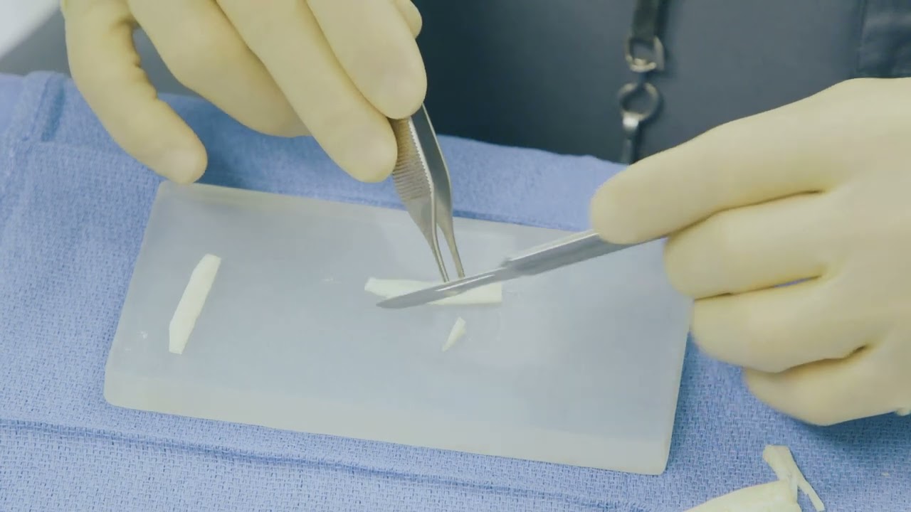 Spreader Graft Sequence