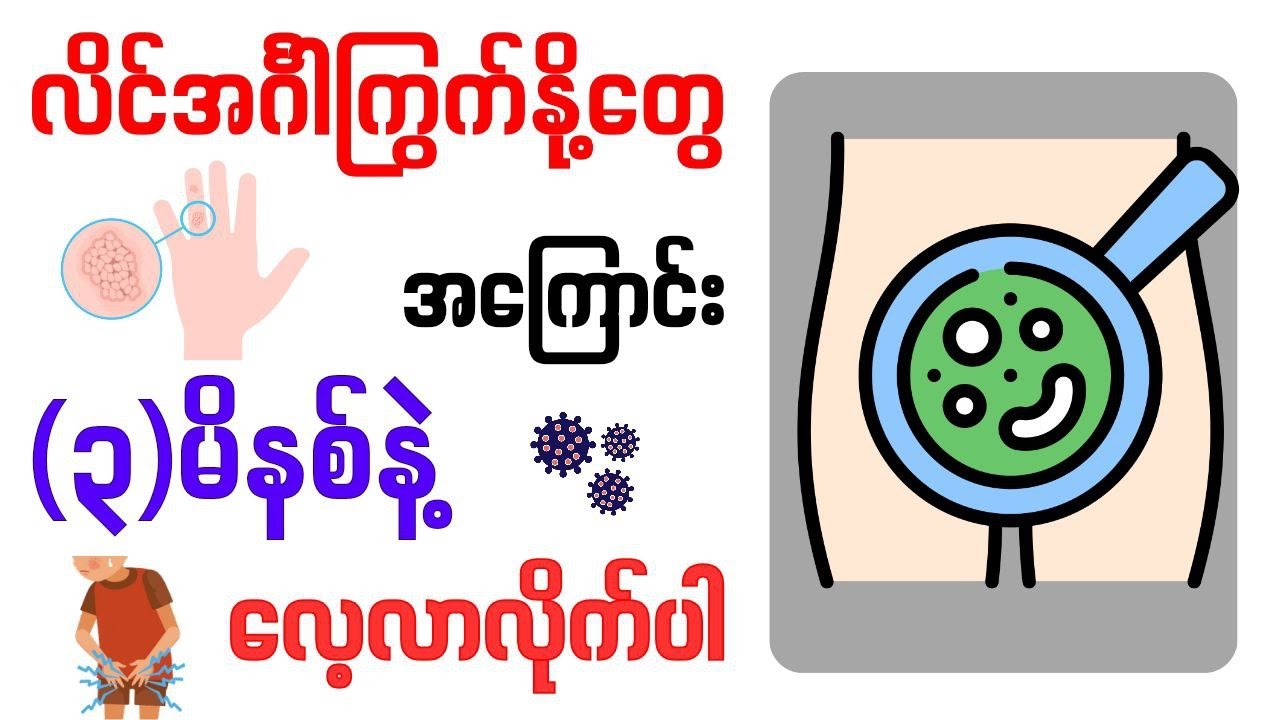 လျှပ်တပြက်ကျန်းမာရေးအပိုင်း (၂၈) လိင်အင်္ဂါကြွက်နို့များ (Genital warts)