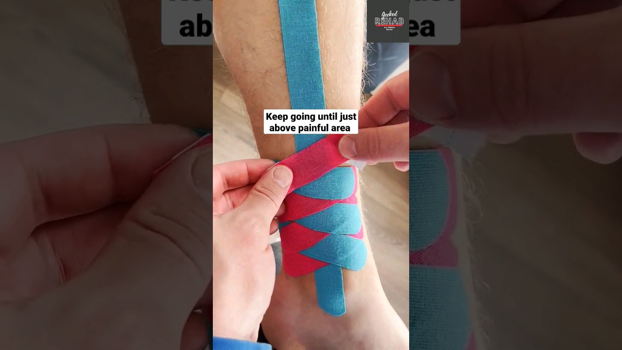 Try this if you are a runner!! Kinesiology Taping shin splints 👀🤯 #runner #legpain #athlete