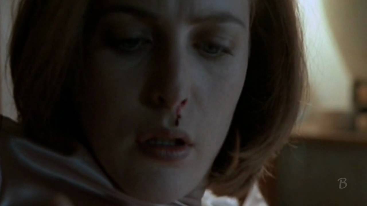 Scully's Cancer - Breathe Me
