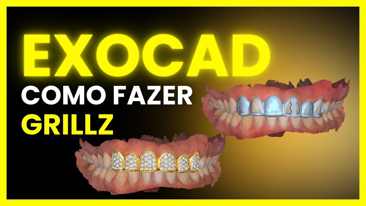 O Segredo Para Fazer GRILLZ Perfeito no Exocad (Poucos Sabem!)