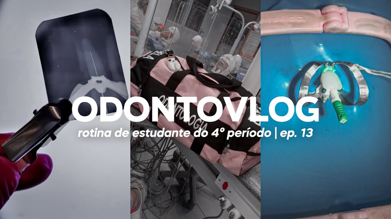 ODONTOVLOG #13: prática de endodontia e biomateriais, bolsa nova e limas | Odonto Energy