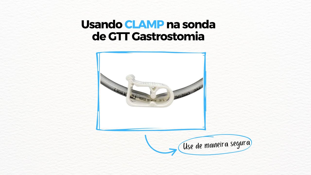Usando CLAMP na sonda de GTT Gastrostomia