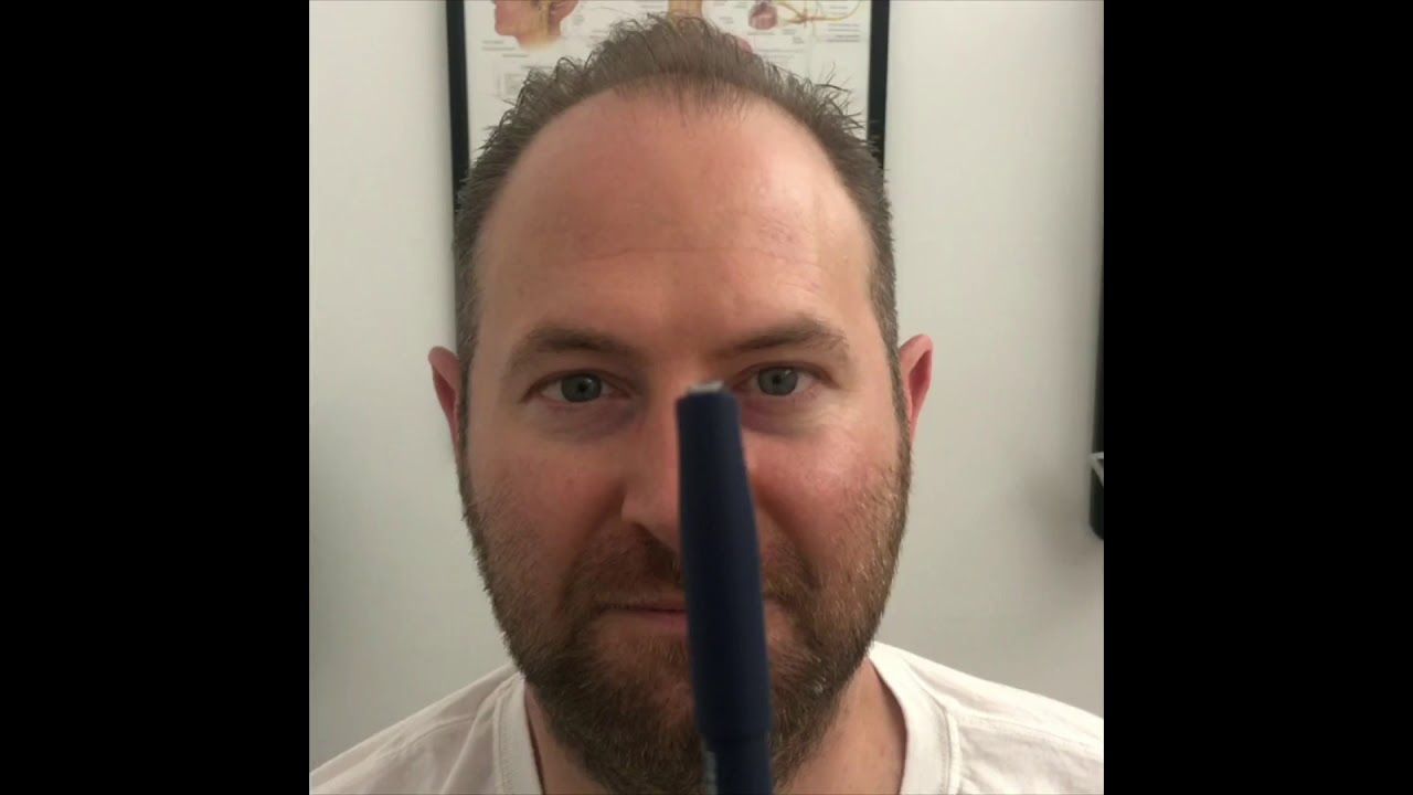 Epley’s maneuver on NYC man with BPPV Vertigo