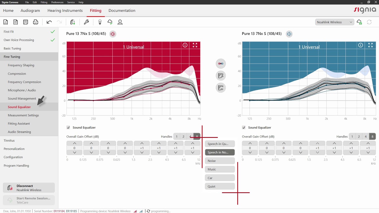Fine Tuning in Connexx 9 | Signia Hearing Aids