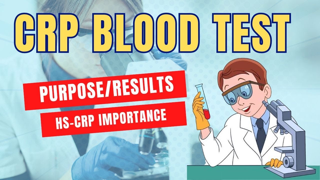 C- Reactive Protein (CRP) Test| Importance| Purpose| Results| HS-CRP