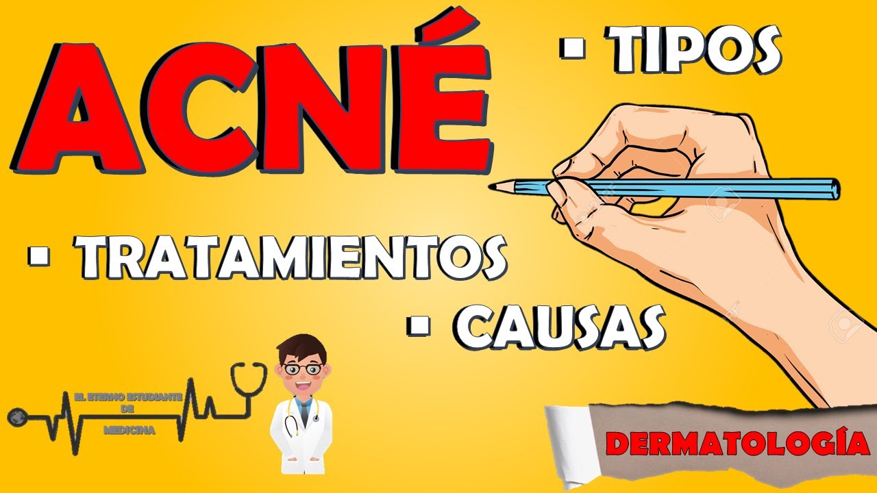 ACNÉ Dermatología | Tipos de acné, causas y tratamientos 📝👨🏻‍⚕️Todo lo que Debes Saber