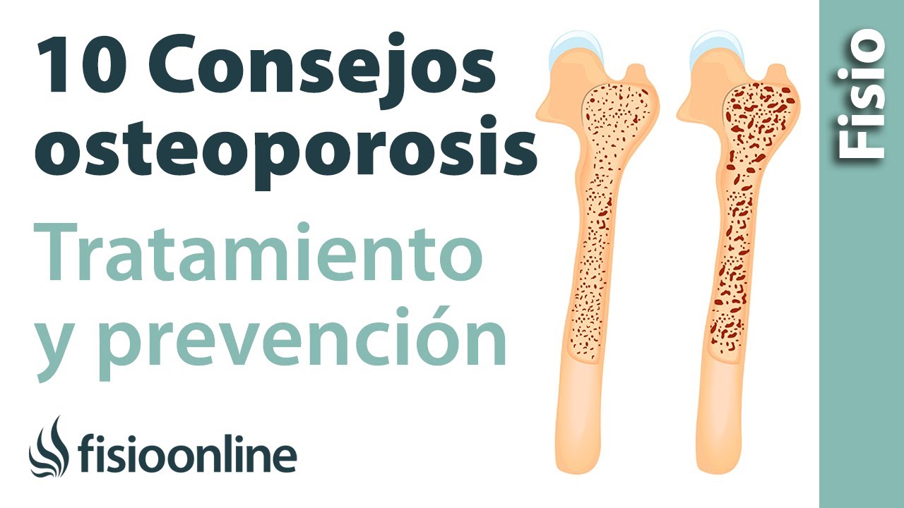 10 consejos para el tratamiento y prevención de la osteoporosis o pérdida de hueso