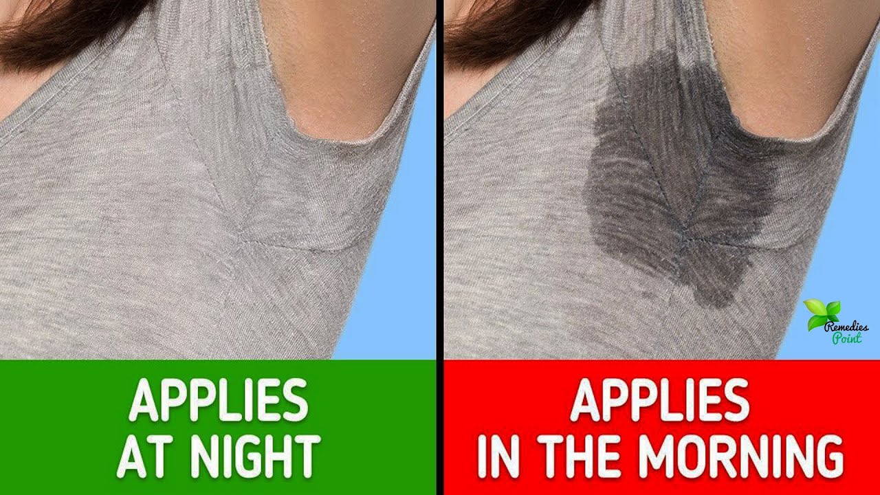 How to Stop Sweaty Armpits | Underarm Sweating - Excessive Sweating Treatment