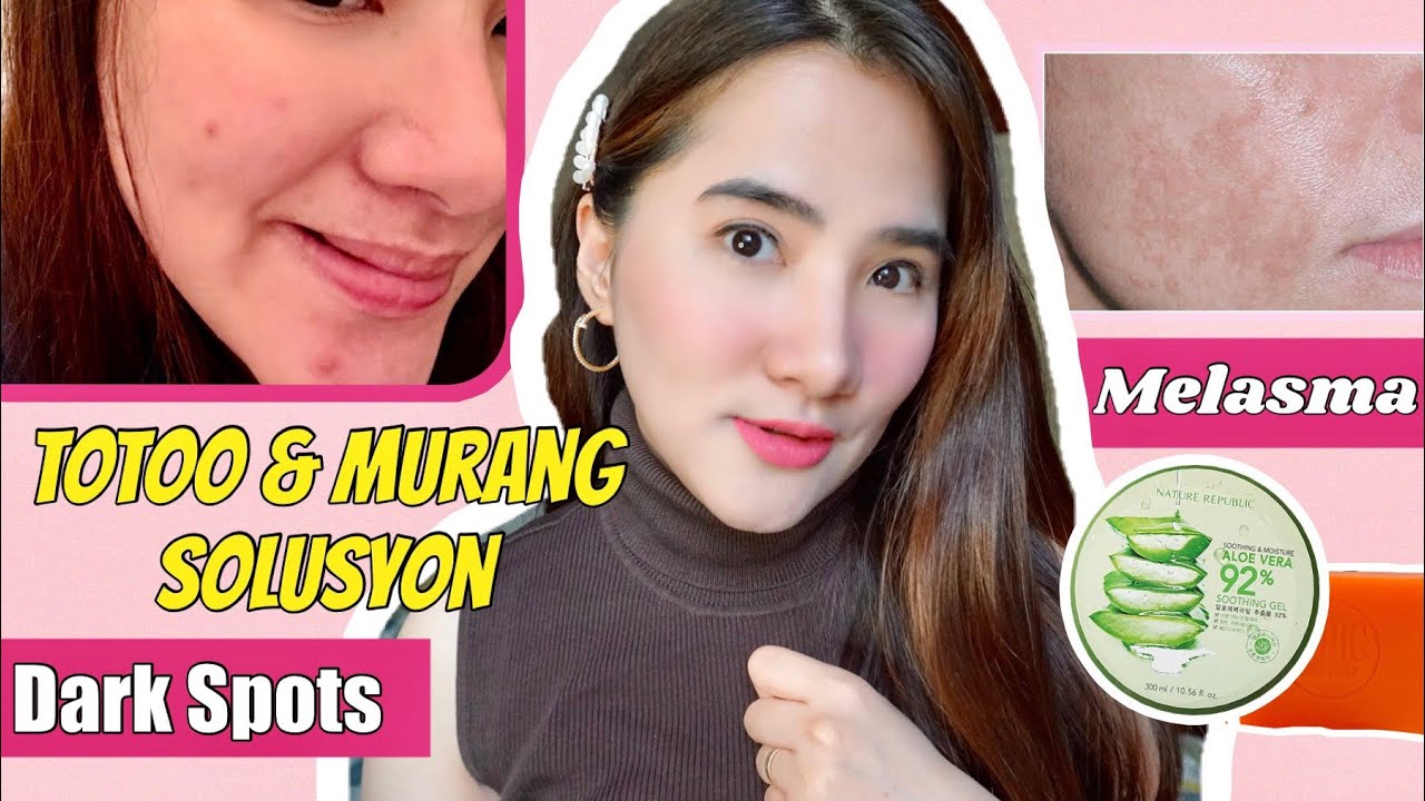 SOLUSYON SA DARK SPOTS, MELASMA & HYPERPIGMENTATION ng MABILIS | KOJIC SOAP ALOE VERA SOOTHING GEL