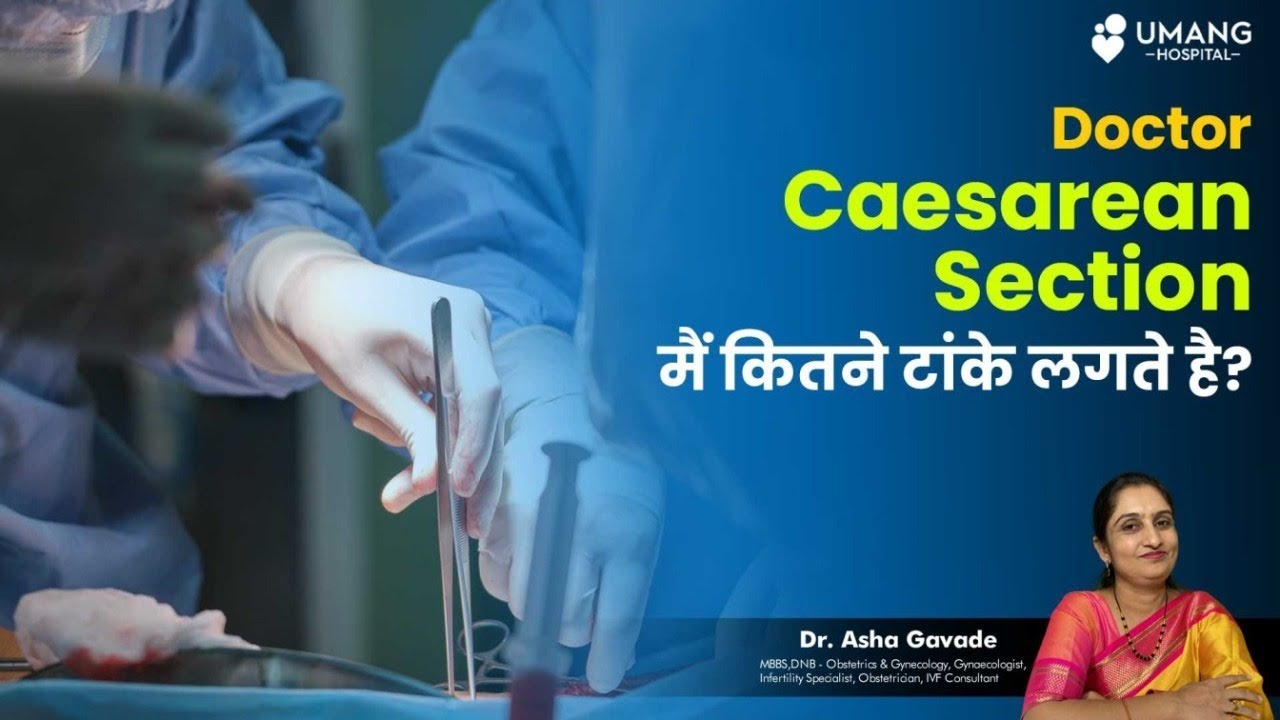 How Many Stitches Applied During Cesarean Section? C-Section Stitch Infections: Signs & Treatment