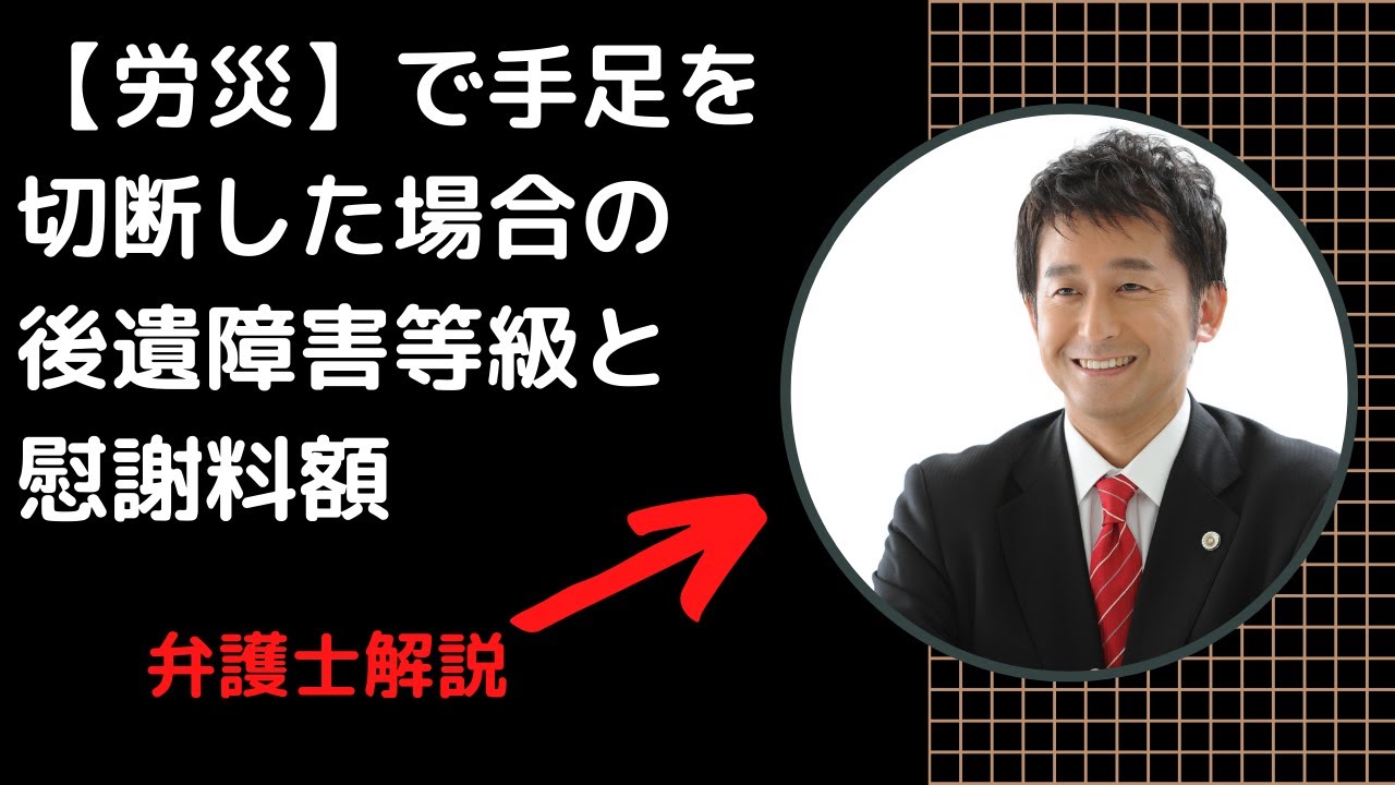 【労災】で手足を切断した場合の後遺障害等級と慰謝料額