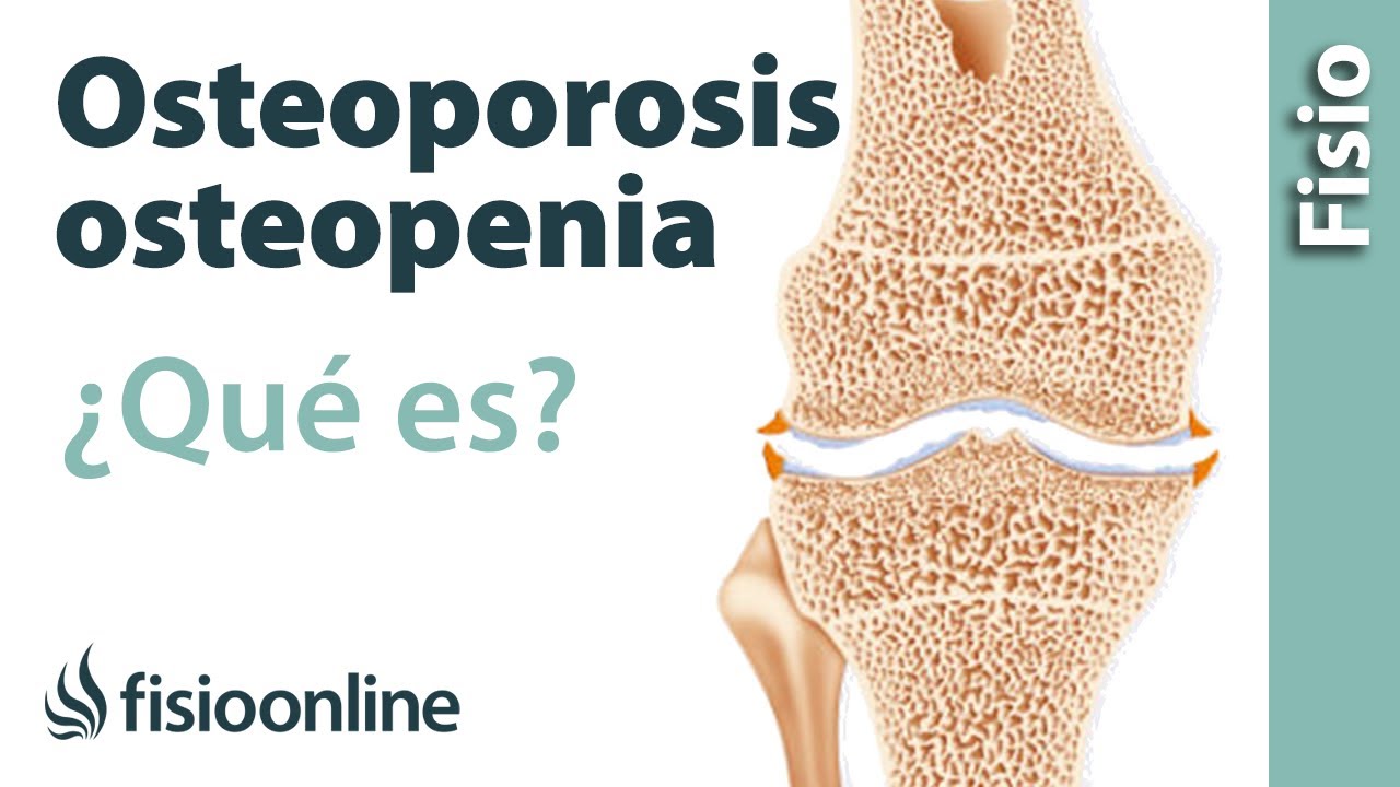 Osteoporosis y osteopenia - ¿Qué es?