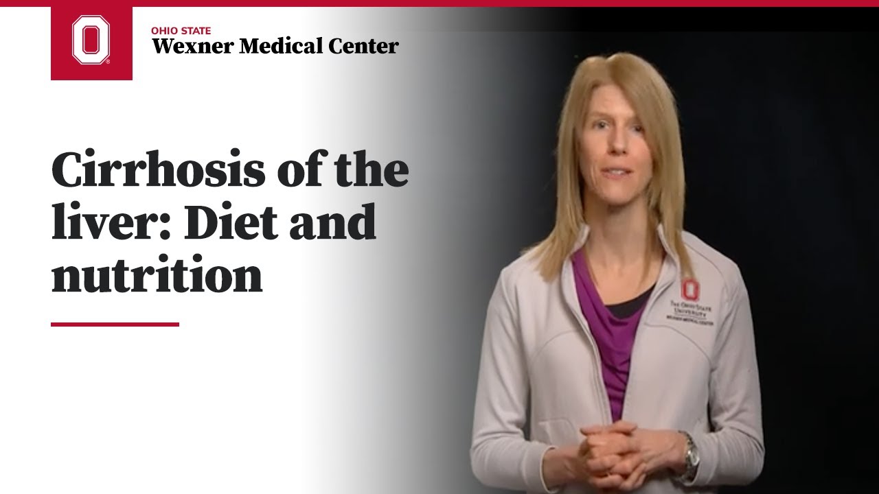 Cirrhosis of the liver: Diet and nutrition | Ohio State Medical Center