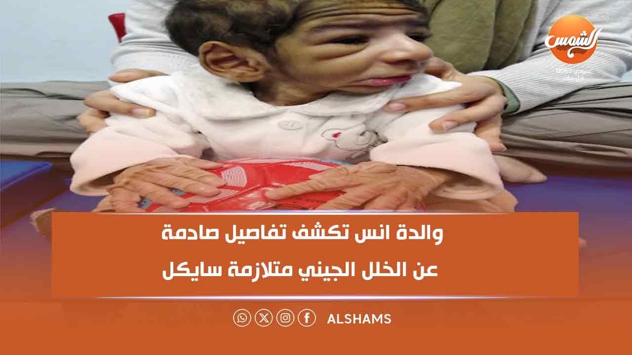 ازاي اكتشفتي المرض بتاع أنس؟ والدة أنس تكشف تفاصيل صادمة عن الخلل الجيني 'متلازمة سايكل'