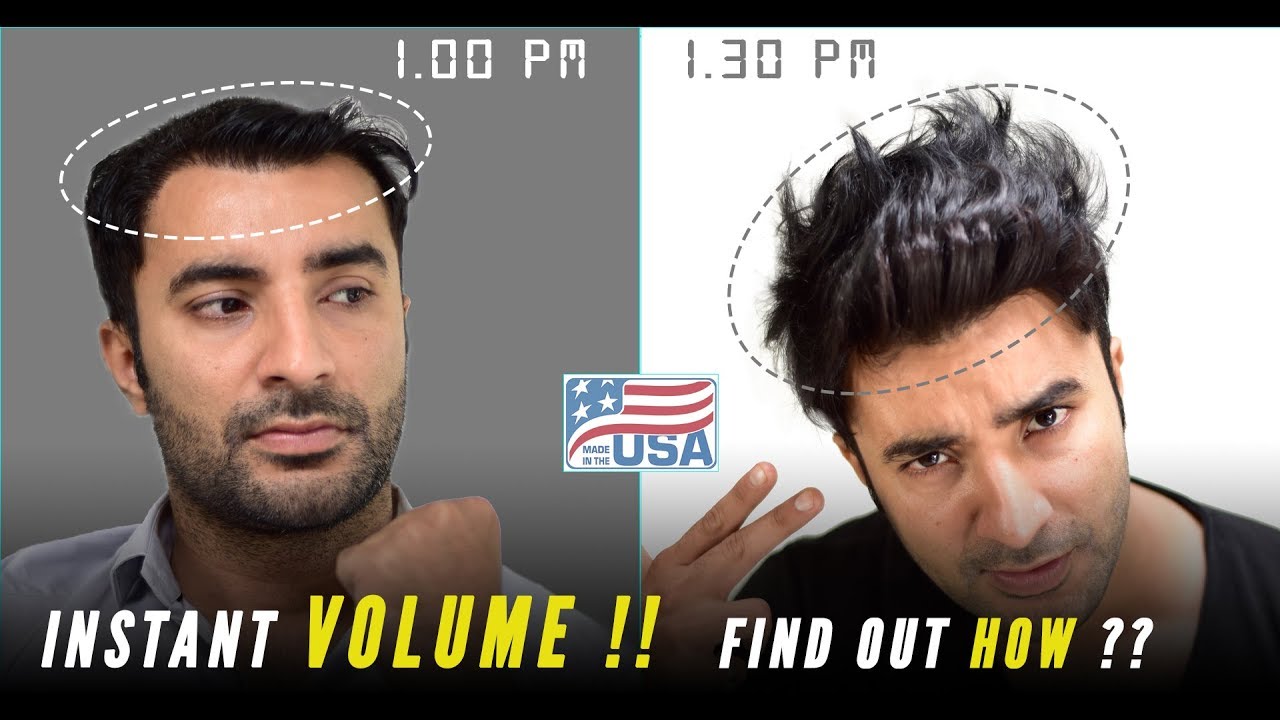 Clip on Hair Systems in India | Hair Patches/Wigs for men
