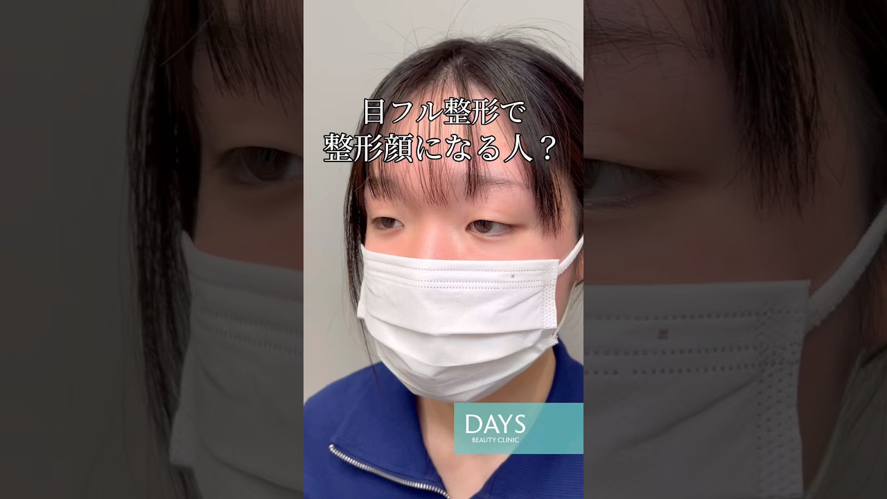 【目フル整形】衝撃のビフォーアフター！#shorts