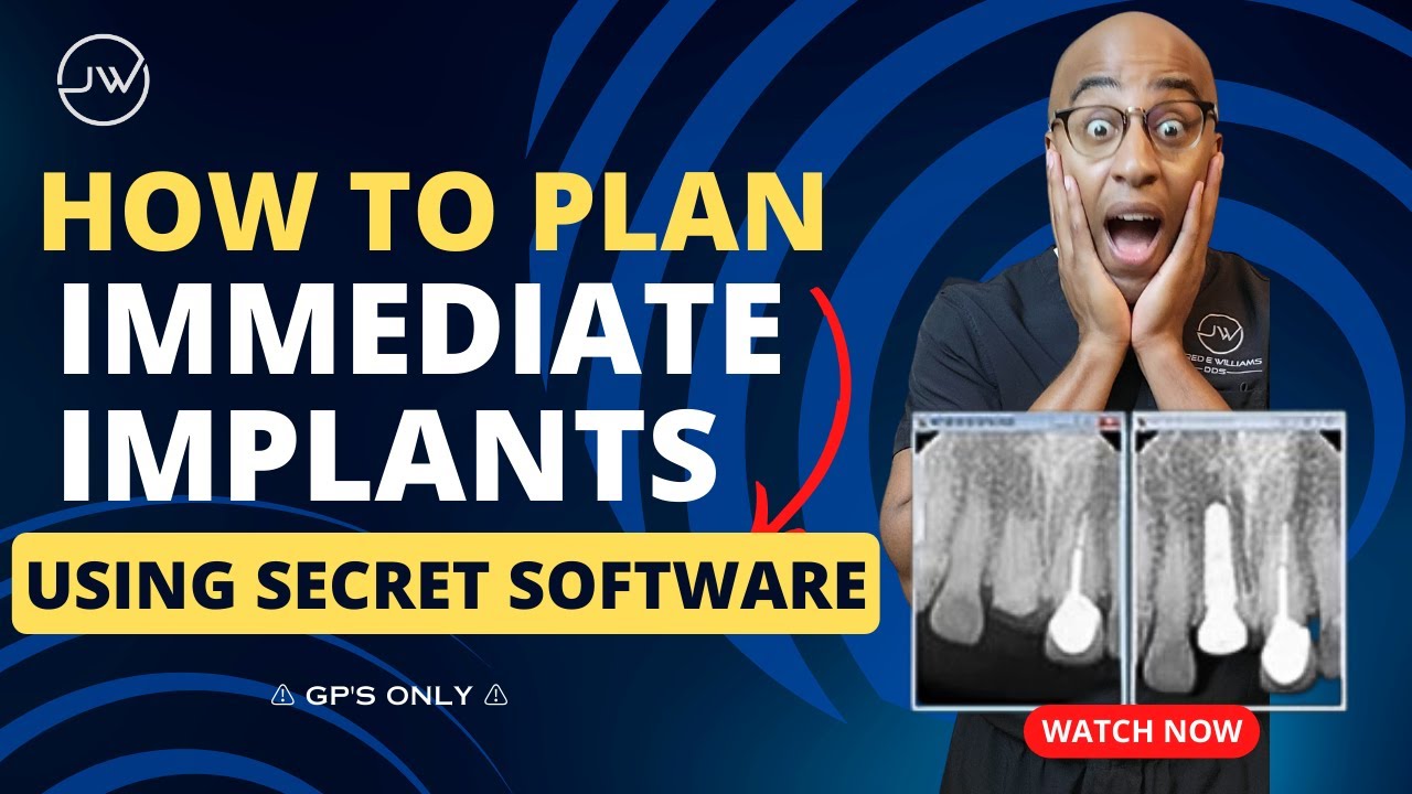 How to plan immediate implants with a CT!!!