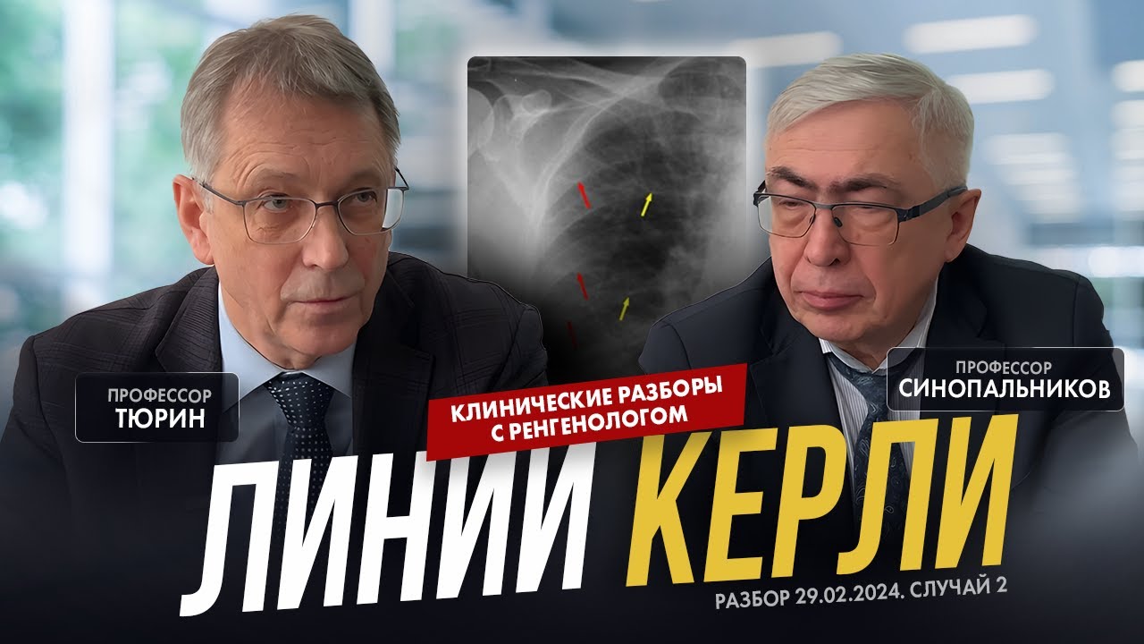 Клинические разборы с рентгенологом. Профессор Тюрин. Линии Керли. 29.02.2024 2 кейс.