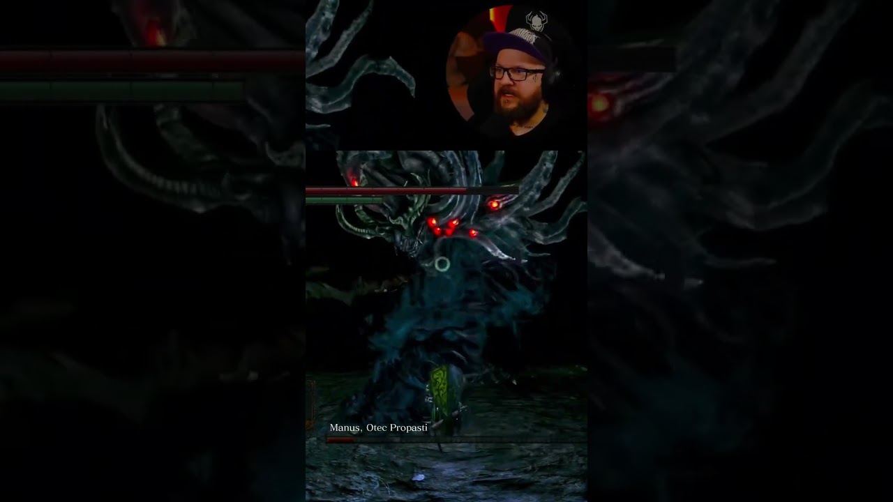 mAnus 