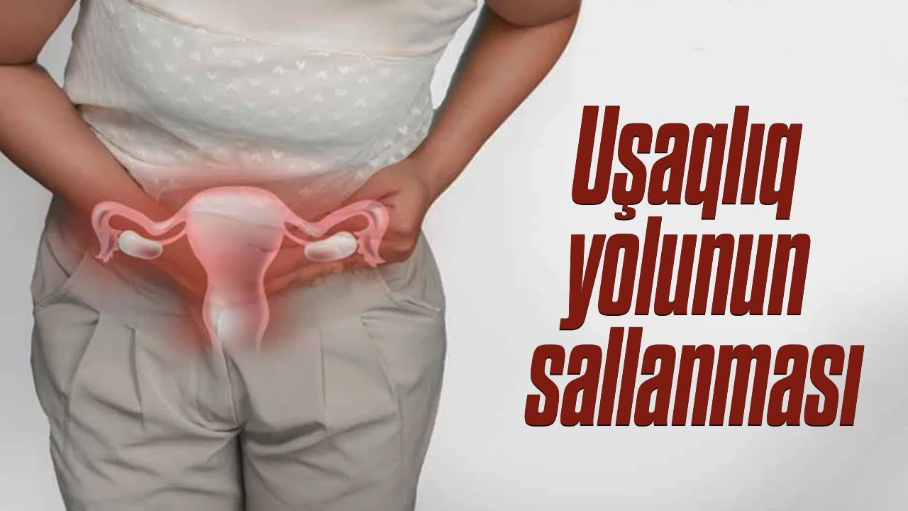 Uşaqlıq yolunun sallanması ( Cərrah - mama ginekoloq Aynurə Nəcəfəliyeva )