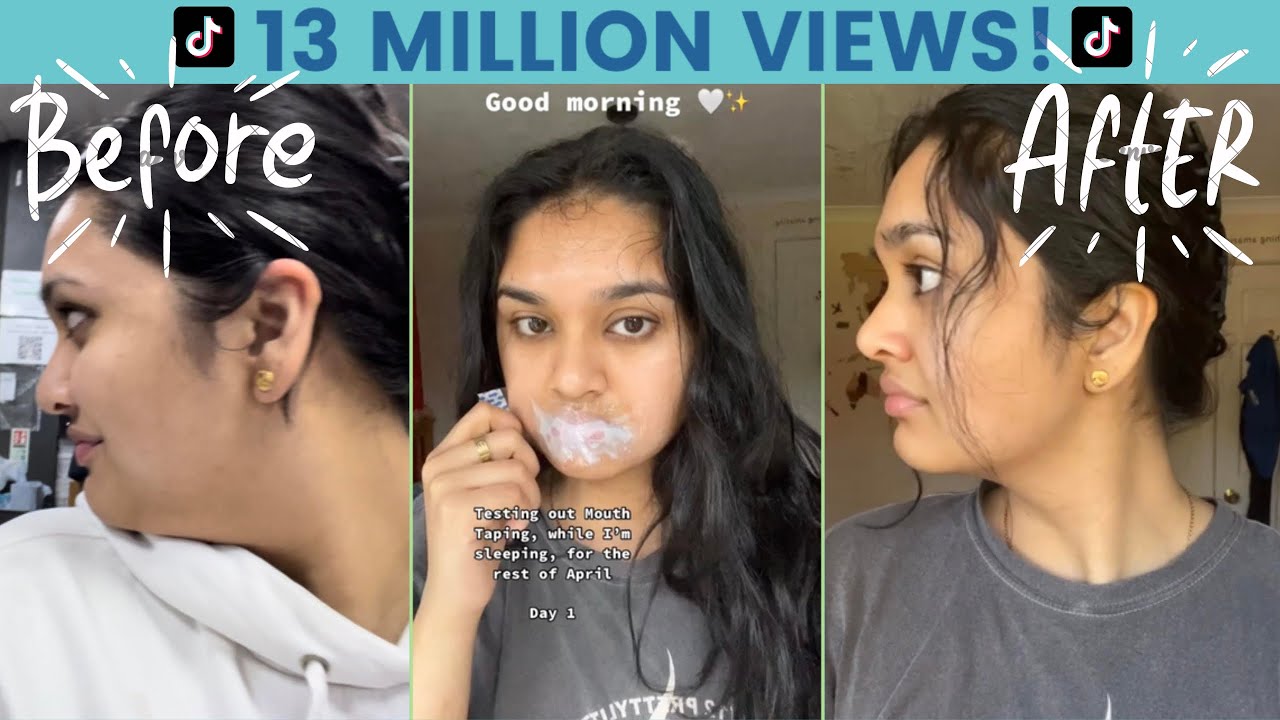Mouth Taping Changed My Life (+ BEFORE & AFTER PICS/VIDS) | Ep19