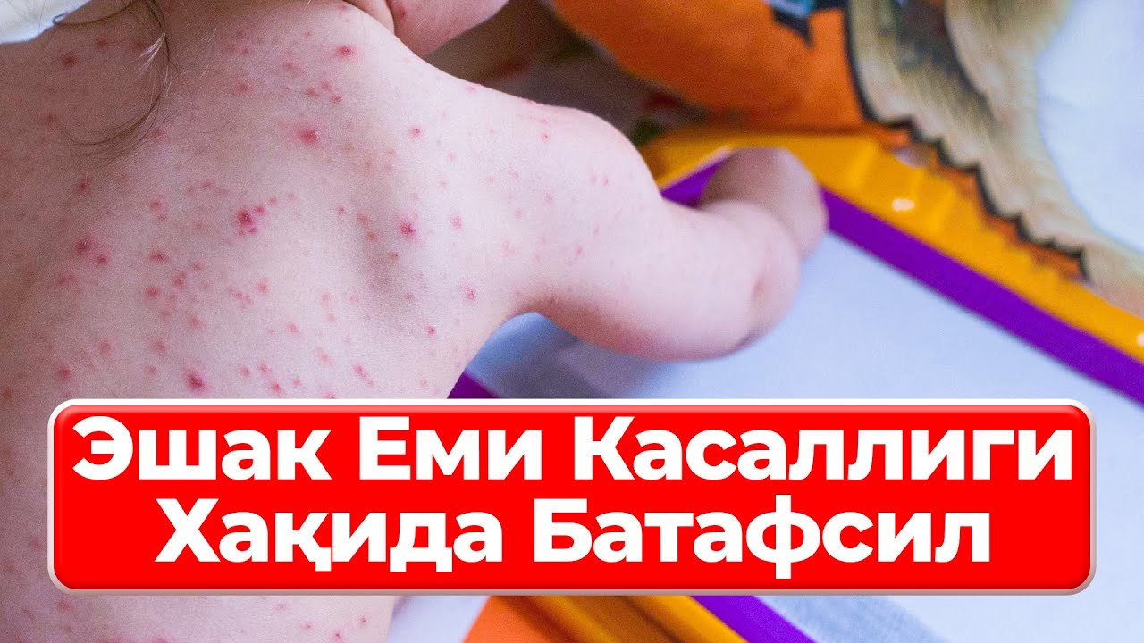 Эшак Еми Касаллиги Хақида Батафсил | Тарвок Касаллиги