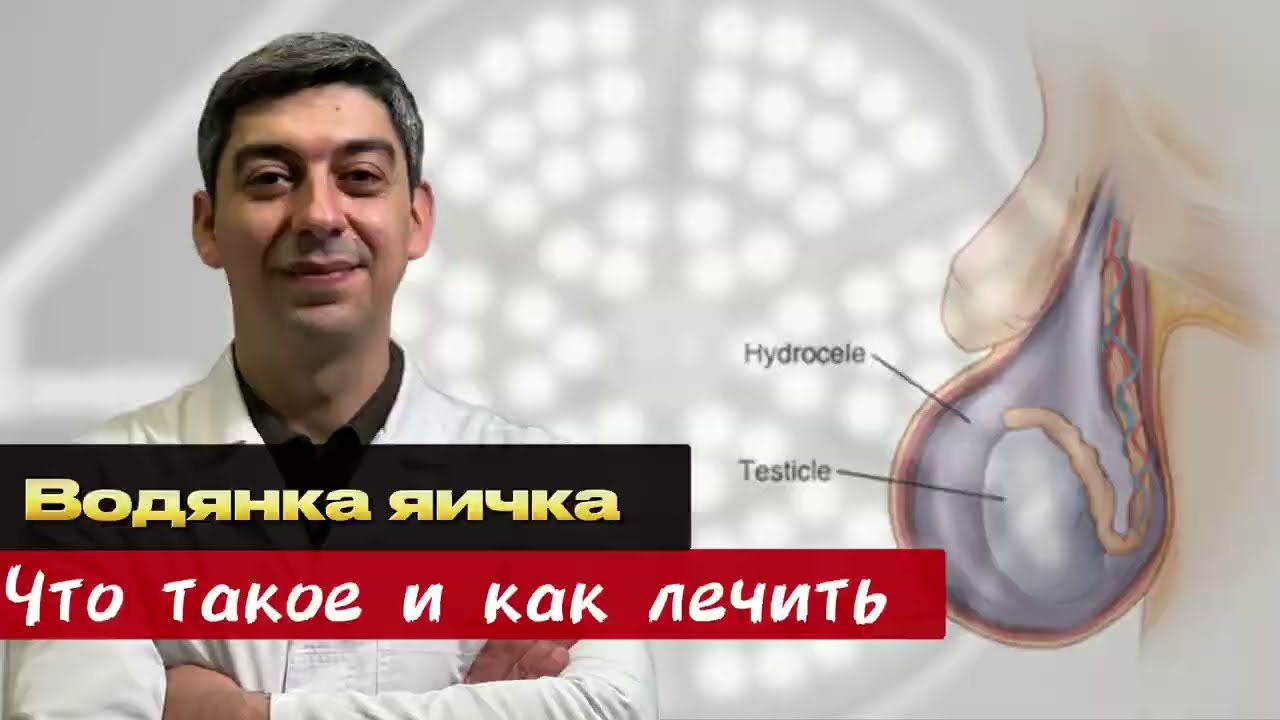 Как это лечить? Гидроцеле (водянка яичка)