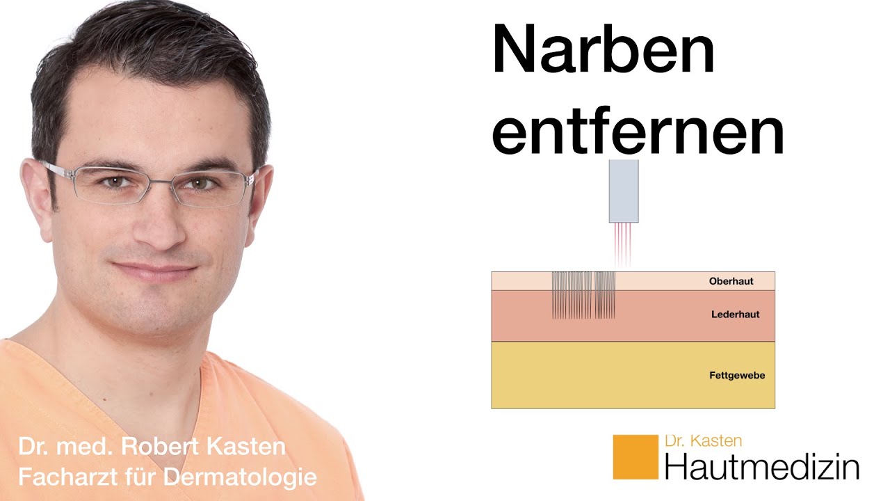Wie kann man Narben entfernen?