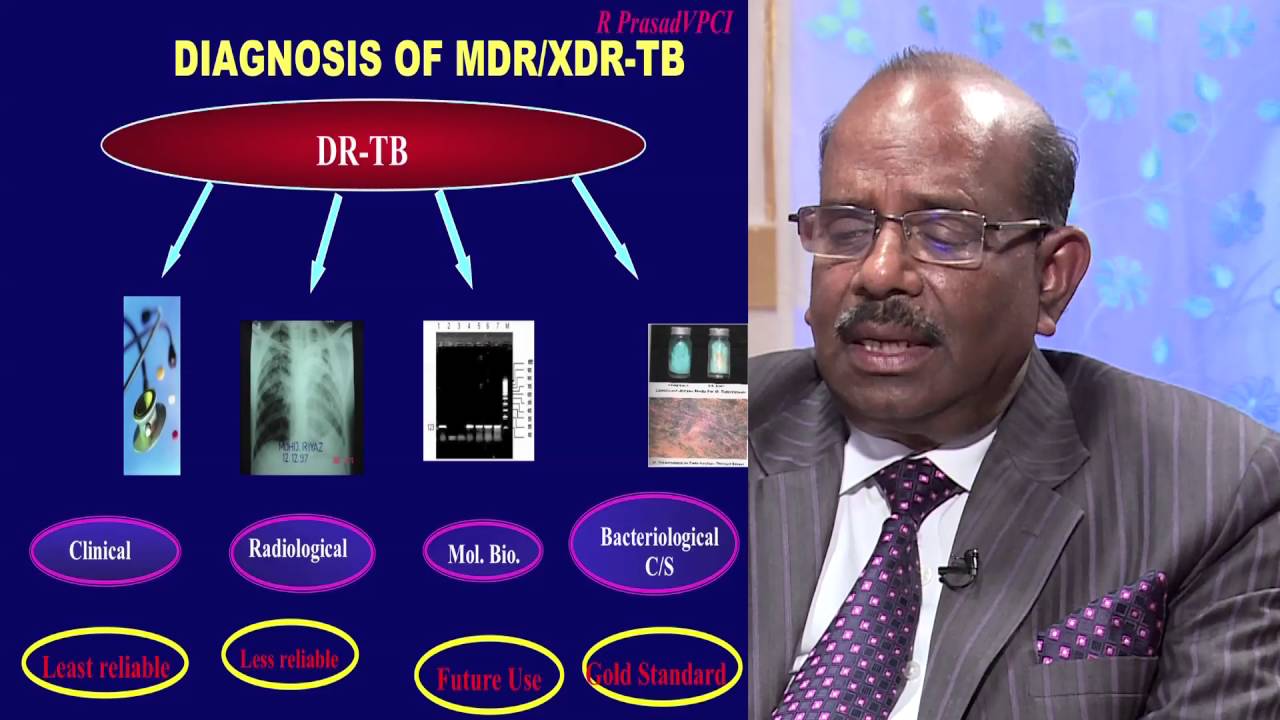 MDR TB...DIAGNOSIS