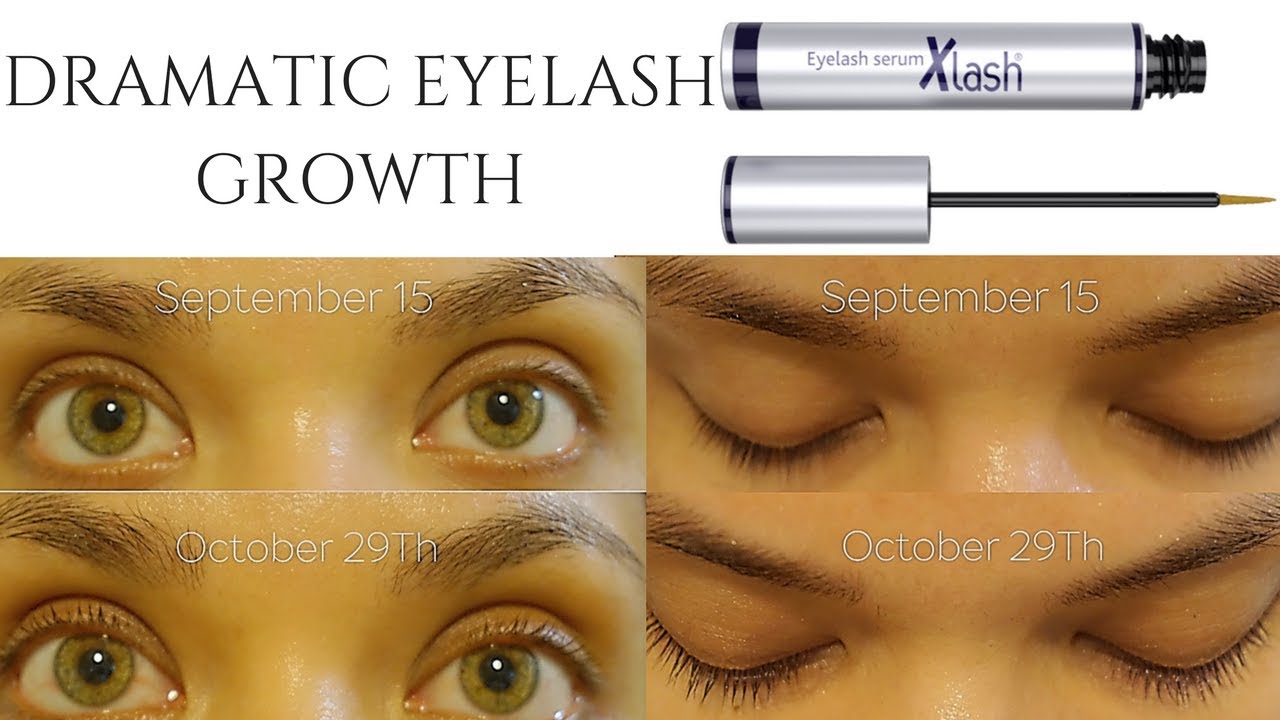 How to grow eyelashes FAST! | XLASH Review, Tips, Before & After!