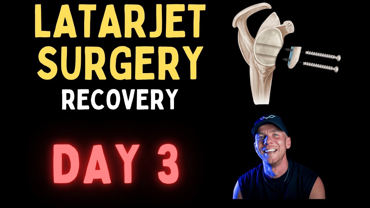 Latarjet Recovery Day 3: Peak Pain & First Shower Attempt