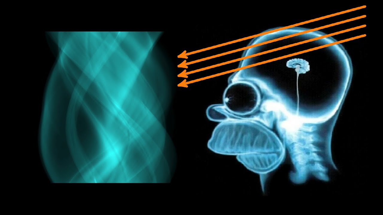 Wie funktioniert ein CT? (Computertomographie, Radon-Transformation)