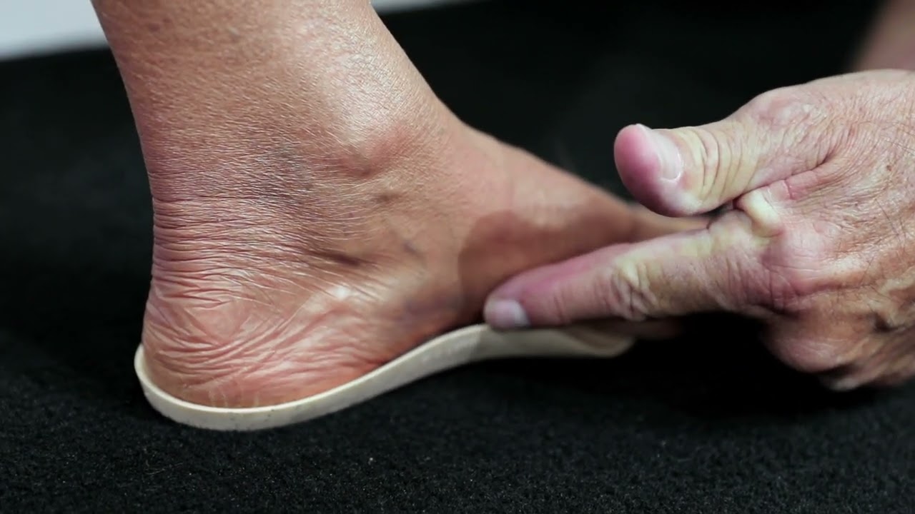 How Natural Foot Orthotics helps Back Pain