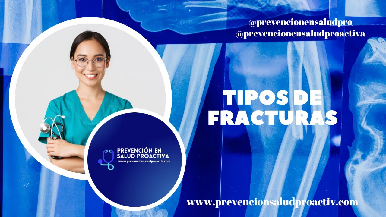 🦴👩&zwj;⚕️Tipos de FRACTURAS⛑️