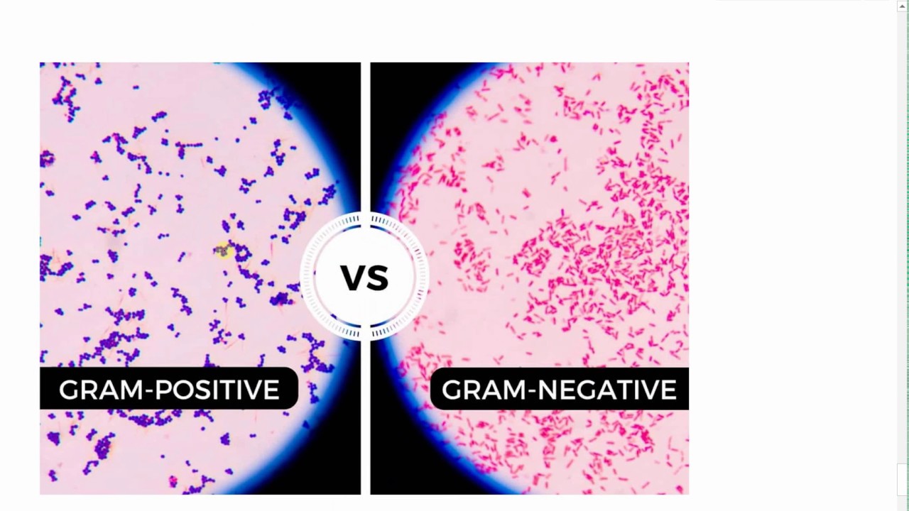 Antibiotics 3: Glycopeptides (Vancomycin)